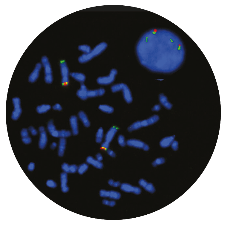 Fluorescence in situ hybridisation (FISH) microscope image of the CytoCell Cri-du-chat and SOTOS Probe Combination.