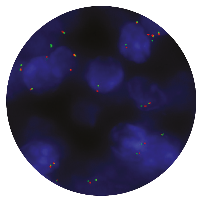 Fluorescence in situ hybridization (FISH) microscope image of the CytoCell PAX3 Breakapart probe.