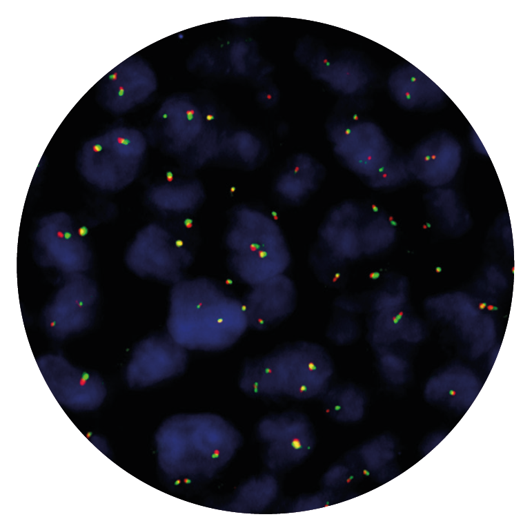 Fluorescence in situ hybridisation (FISH) microscope image of the CytoCell IGH Breakapart probe.