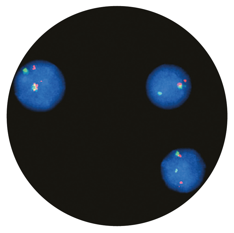 Fluorescence in situ hybridization (FISH) microscope image of the CytoCell IGH Breakapart probe.