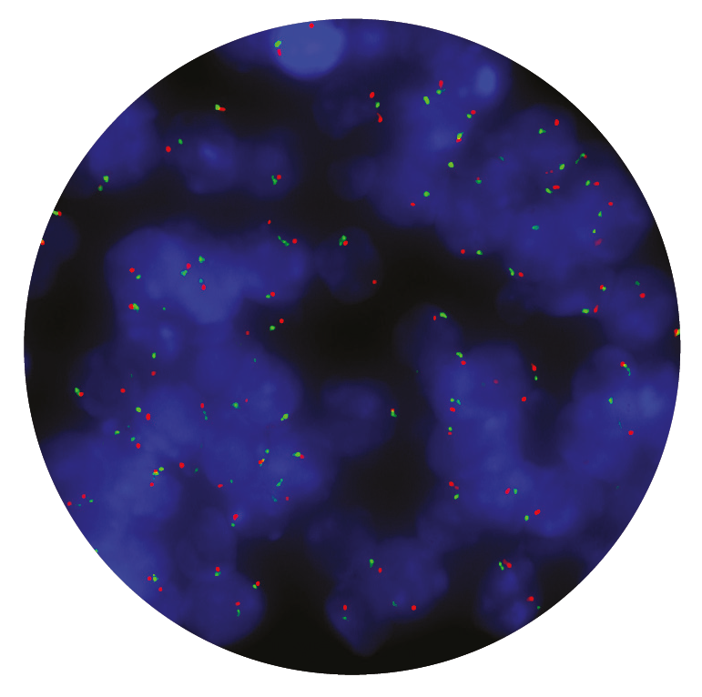 Fluorescence in situ hybridisation (FISH) microscope image of the CytoCell EGFR Amplification probe.