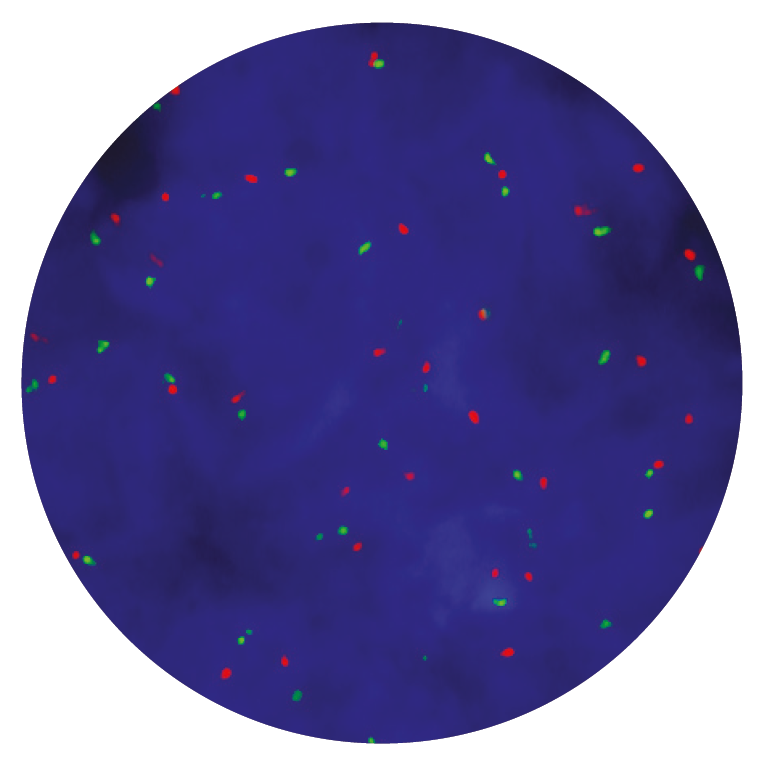 Fluorescence in situ hybridisation (FISH) microscope image of the CytoCell C-MET (MET) Amplification probe.