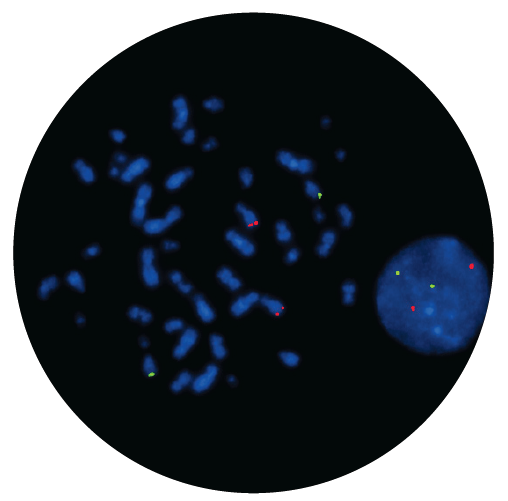 Fluorescence in situ hybridisation (FISH) microscope image of the CytoCell IGH/cMYC (MYC) Translocation, Dual Fusion probe.