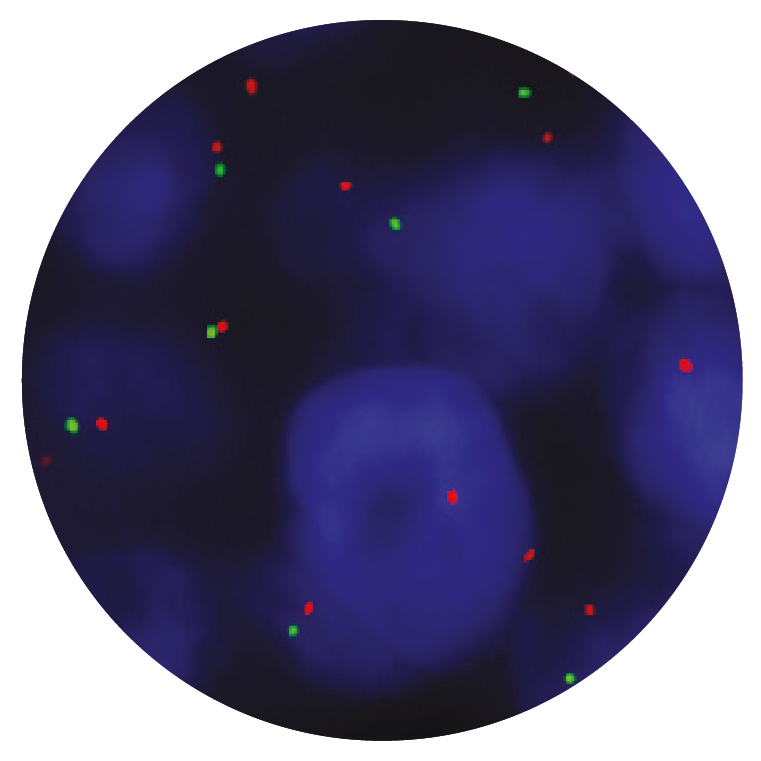 Fluorescence in situ hybridisation (FISH) microscope image of the CytoCell RB1 Deletion probe.