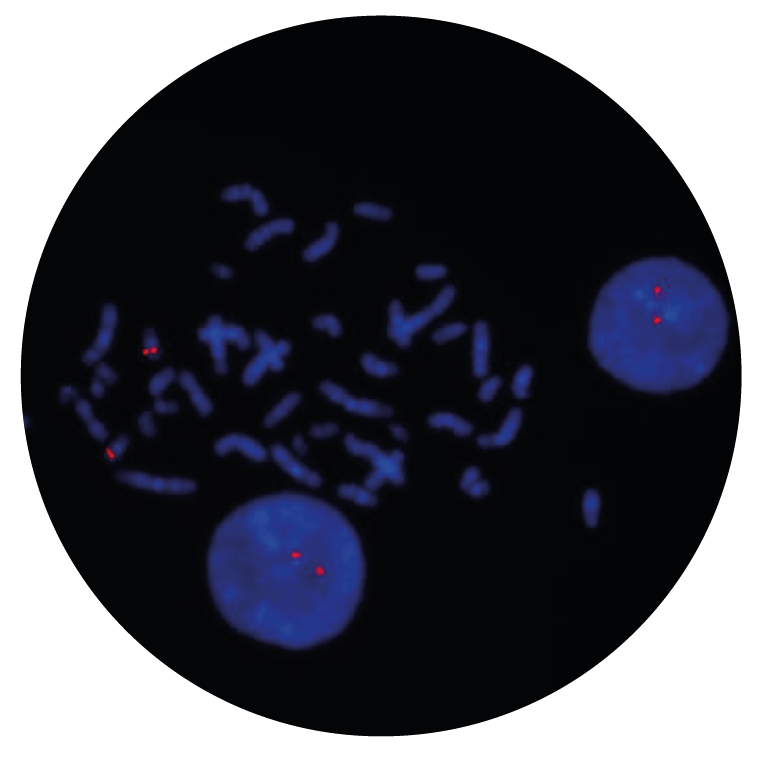 Fluorescence in situ hybridization (FISH) microscope image of the CytoCell CBFB Proximal Probe Red.