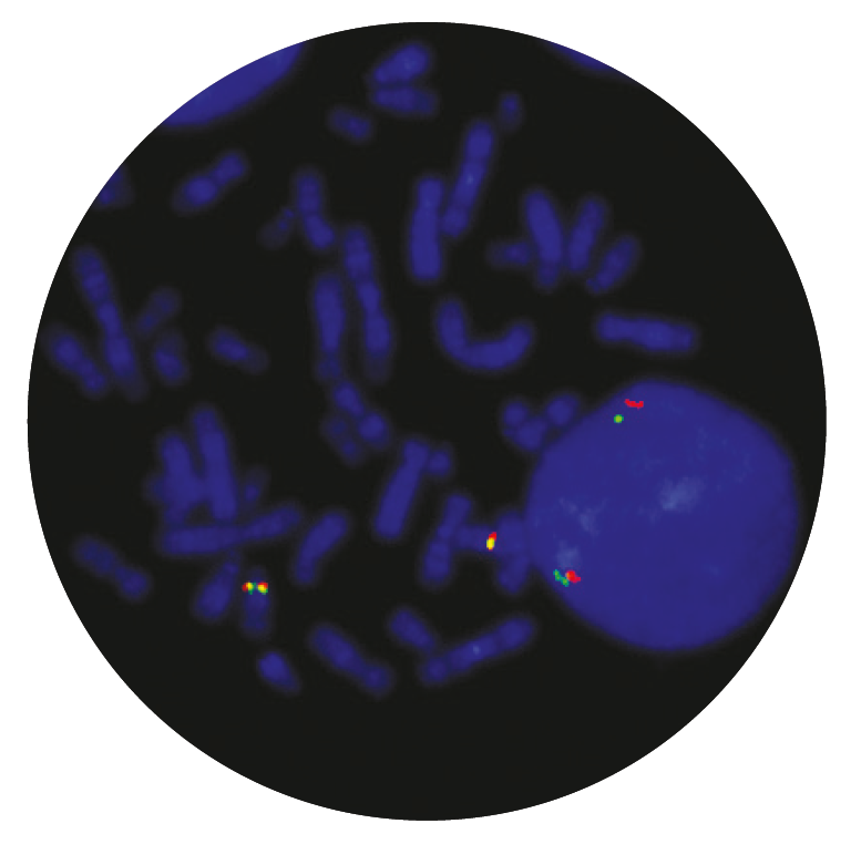 Fluorescence in situ hybridisation (FISH) microscope image of the CytoCell TCRAD Breakapart probe.
