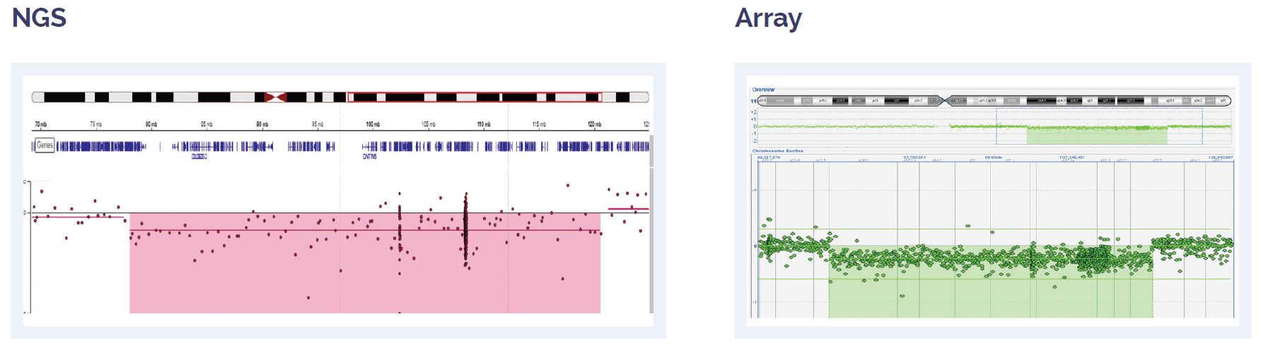 Software data showing the concordance between aCGH and NGS results for a 42.7Mb deletion of 11q covering ATM.