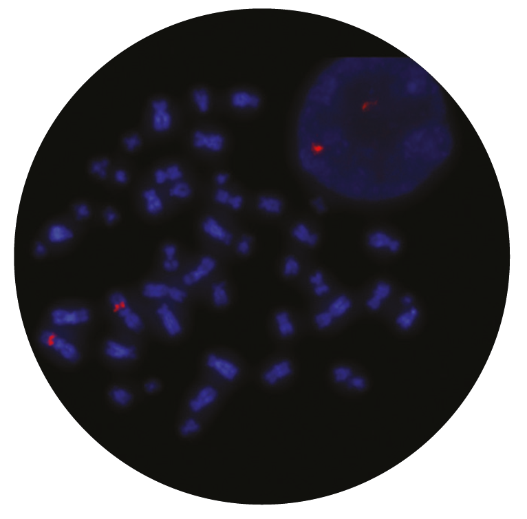 Fluorescence in situ hybridization (FISH) microscope image of the CytoCell PBX1 probe.