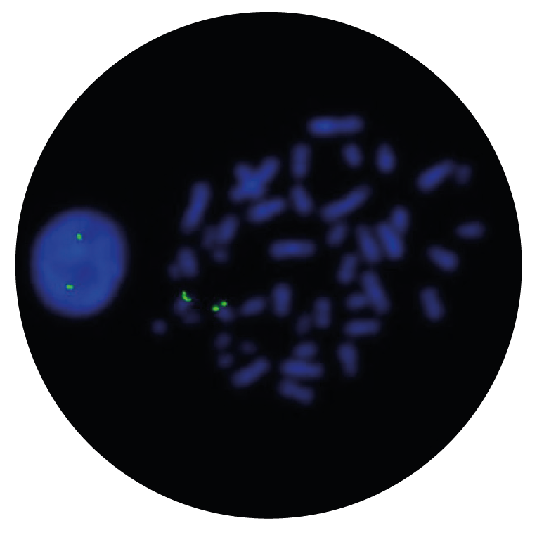 Fluorescence in situ hybridization (FISH) microscope image of the CytoCell CBFB Distal Probe Green.
