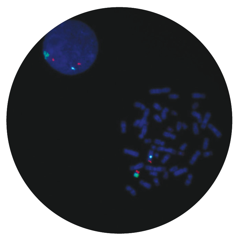 Fluorescence in situ hybridisation (FISH) microscope image of the CytoCell SHOX probe.