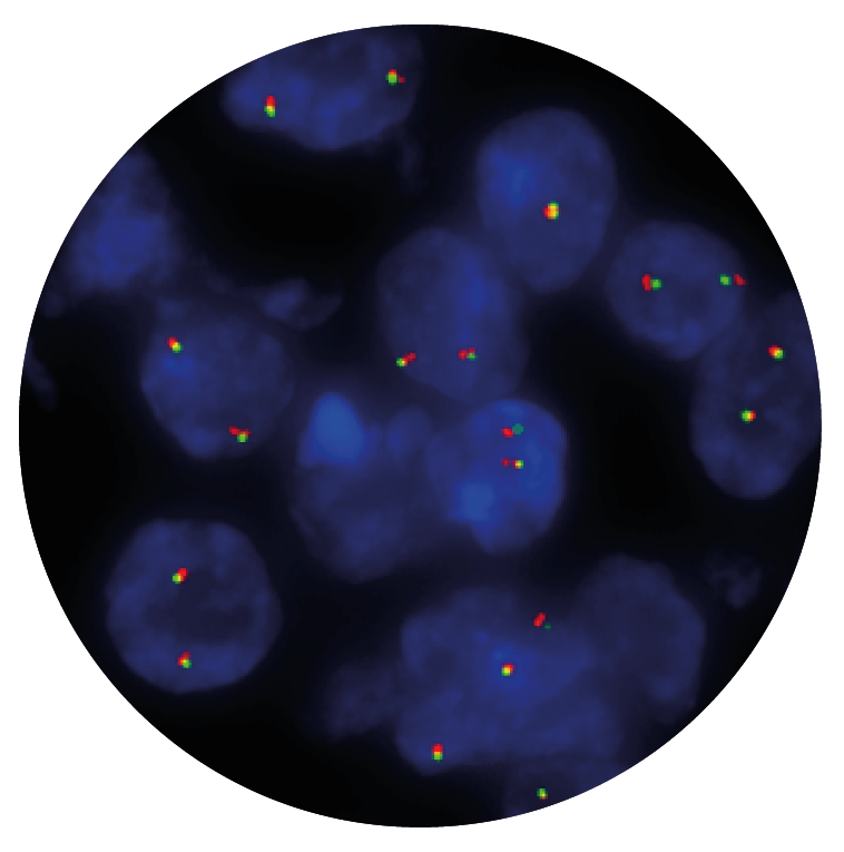 Fluorescence in situ hybridisation (FISH) microscope image of the CytoCell ALK Breakapart probe.
