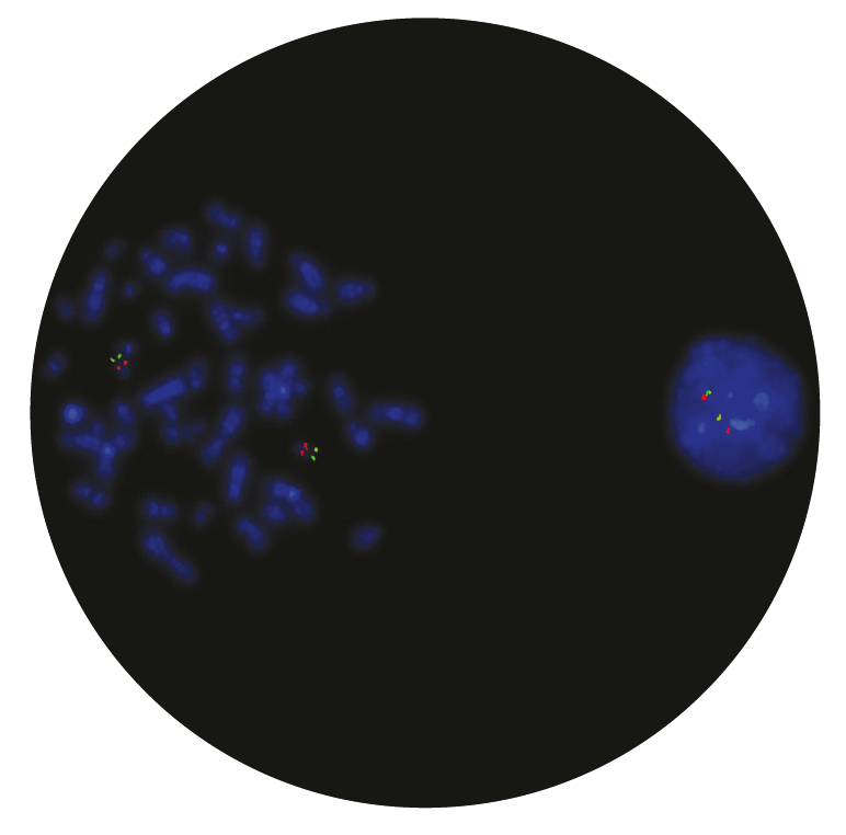 Fluorescence in situ hybridization (FISH) microscope image of the CytoCell DiGeorge TBX1 Region and 22q13.3 Region probe.