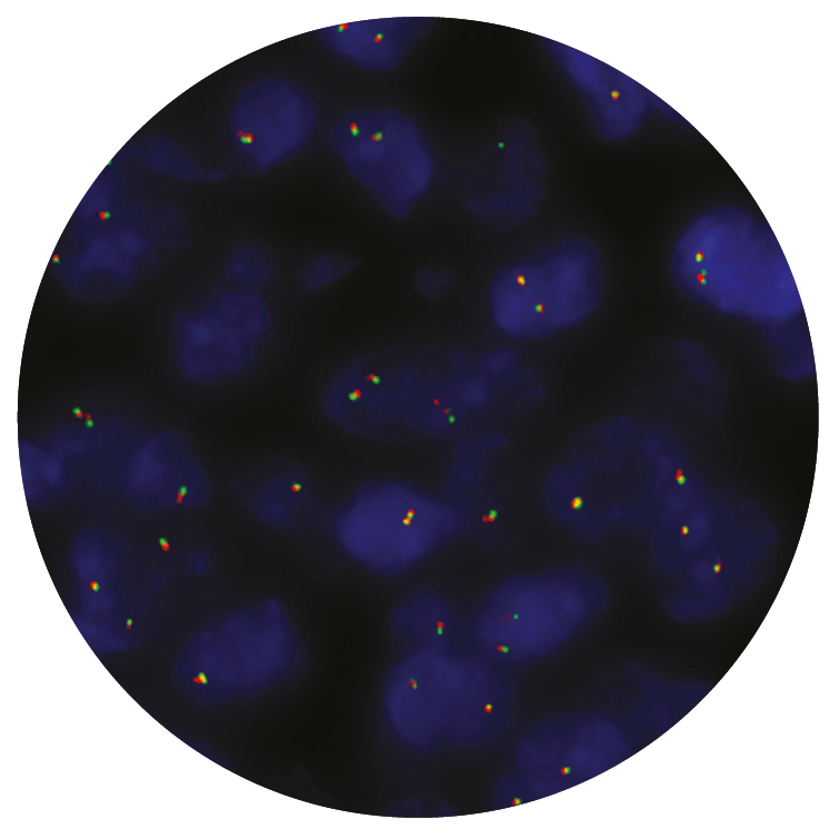 Fluorescence in situ hybridization (FISH) microscope image of the CytoCell IGL Breakapart probe.