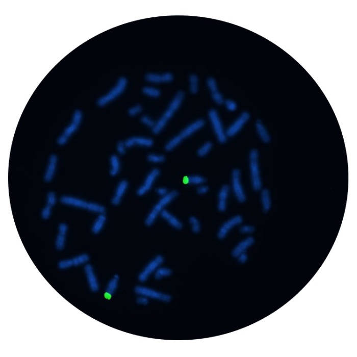 Fluorescence in situ hybridization (FISH) microscope image of the CytoCell IGH Probe Green.