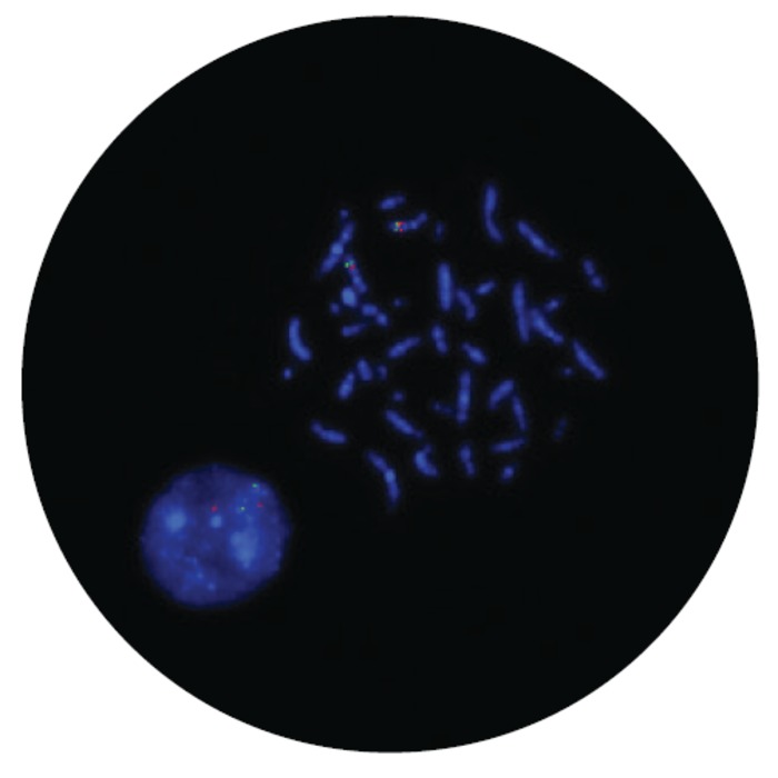 Fluorescence in situ hybridization (FISH) microscope image of the FDA-cleared CytoCell Del(7q) Deletion probe.