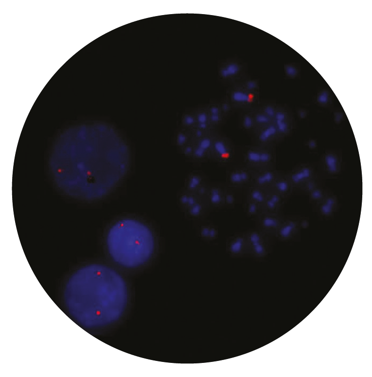 Fluorescence in situ hybridization (FISH) microscope image of the CytoCell FGFR3 Plus probe.