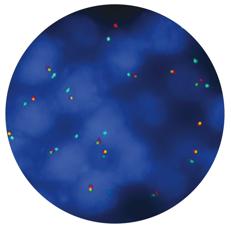 Fluorescence in situ hybridization (FISH) microscope image of the CytoCell FGFR1 Breakapart/Amplification probe.