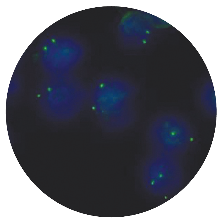 Fluorescence in situ hybridization (FISH) microscope image of the CytoCell 1q25 probe.