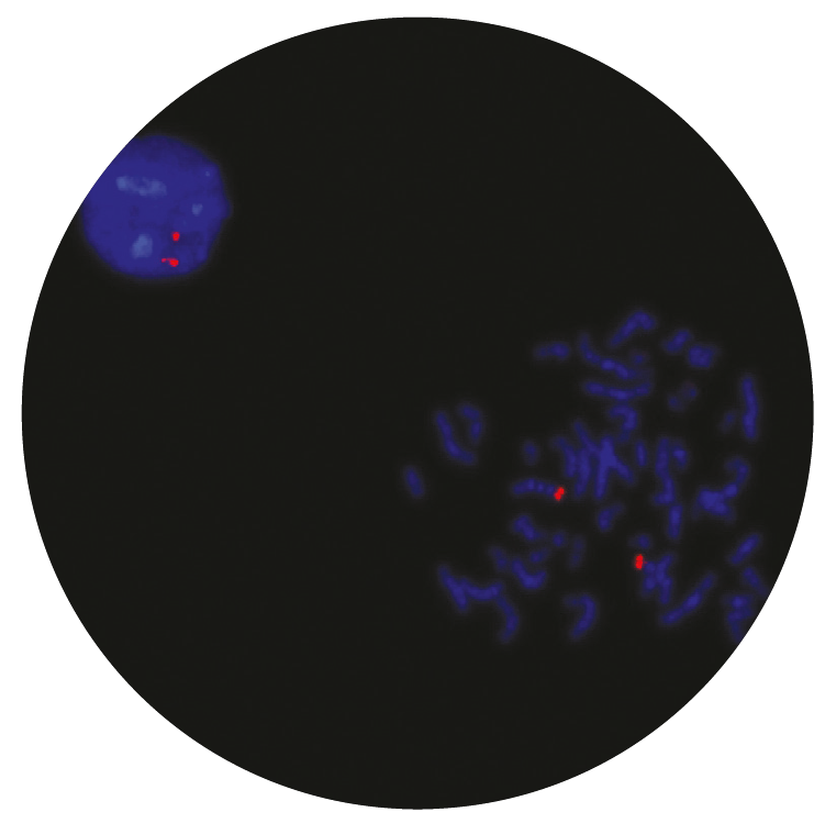 Fluorescence in situ hybridization (FISH) microscope image of the CytoCell EZH2 (7q36) Probe Red.