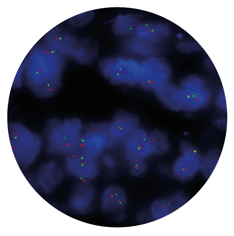 Fluorescence in situ hybridisation (FISH) microscope image of the CytoCell BCL2 Breakapart probe.
