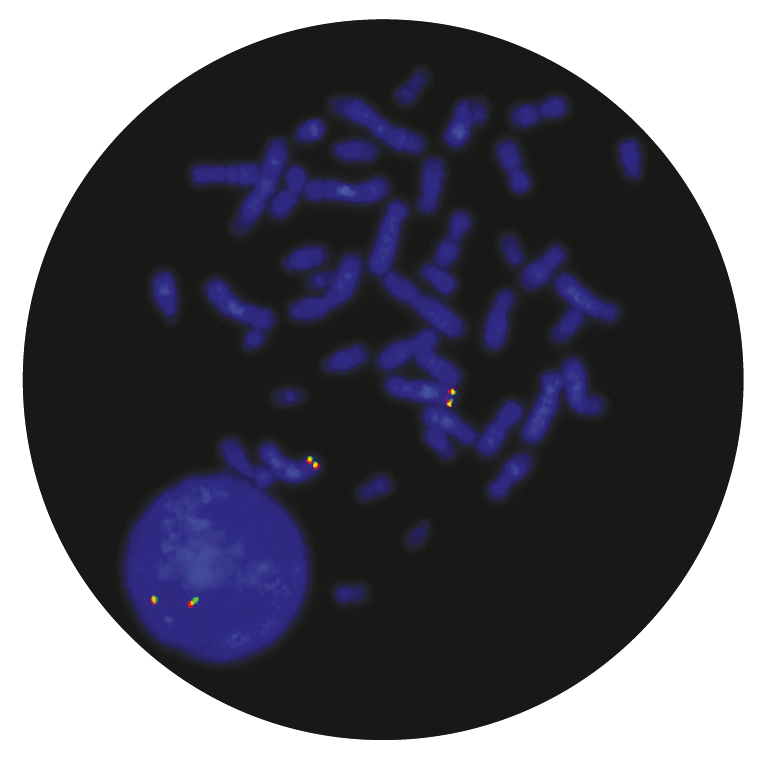 Fluorescence in situ hybridization (FISH) microscope image of the CytoCell TLX3 Breakapart probe.
