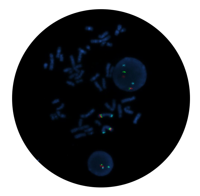 Fluorescence in situ hybridisation (FISH) microscope image of the CytoCell Del(5q) Plus Tri-Colour Deletion probe.