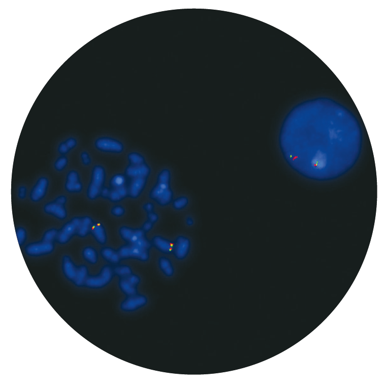 Fluorescence in situ hybridization (FISH) microscope image of the CytoCell cMYC (MYC) Breakapart probe.