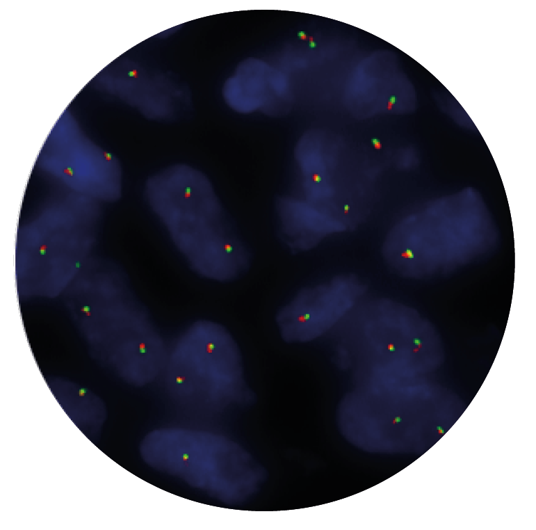 Fluorescence in situ hybridization (FISH) microscope image of the CytoCell EML4 Breakapart probe.