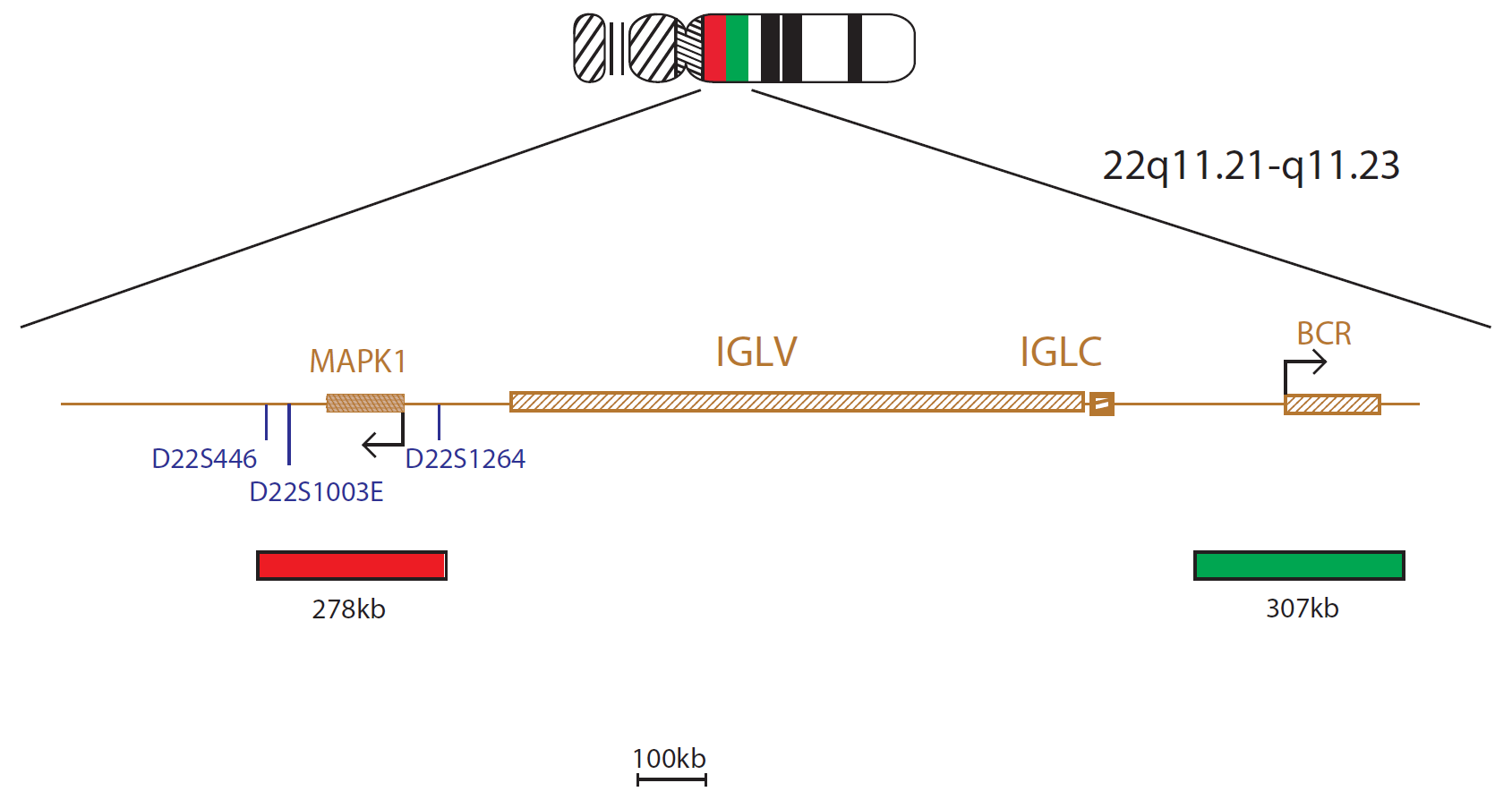 Fluorescence in situ hybridization (FISH) chromosome map showing a probe targeting the IGL gene.