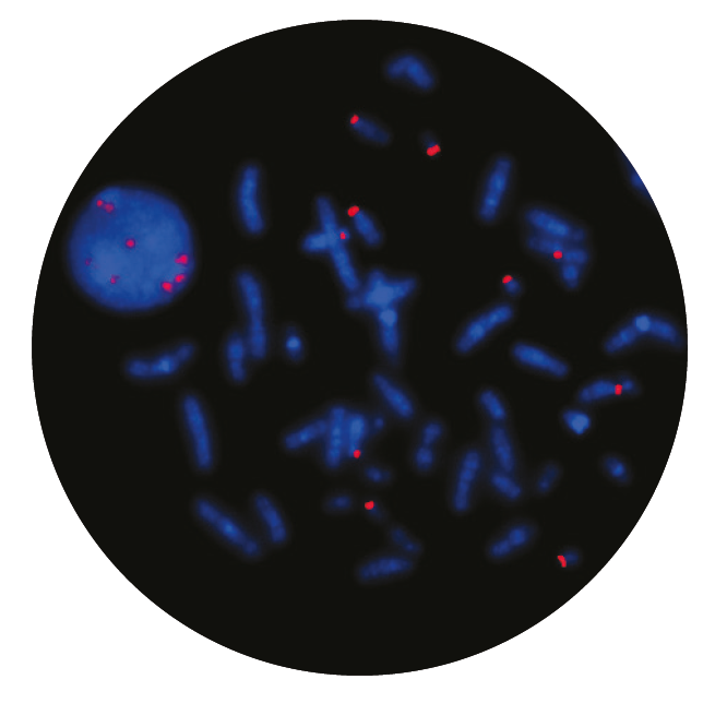 Fluorescence in situ hybridisation (FISH) microscope image of the CytoCell Acro-P-Arm probe.