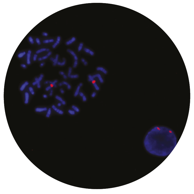 Fluorescence in situ hybridization (FISH) microscope image of the CytoCell AFF1 probe.