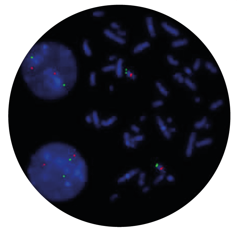 Fluorescence in situ hybridization (FISH) microscope image of the CytoCell D13S25 Deletion probe.