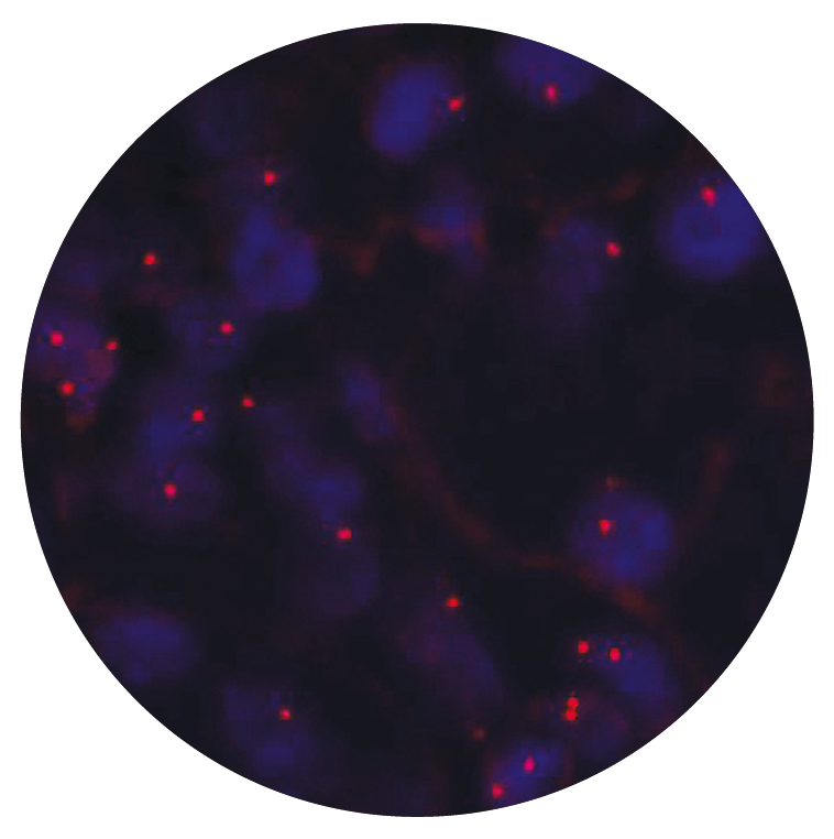 Fluorescence in situ hybridization (FISH) microscope image of the CytoCell 1p36 probe.