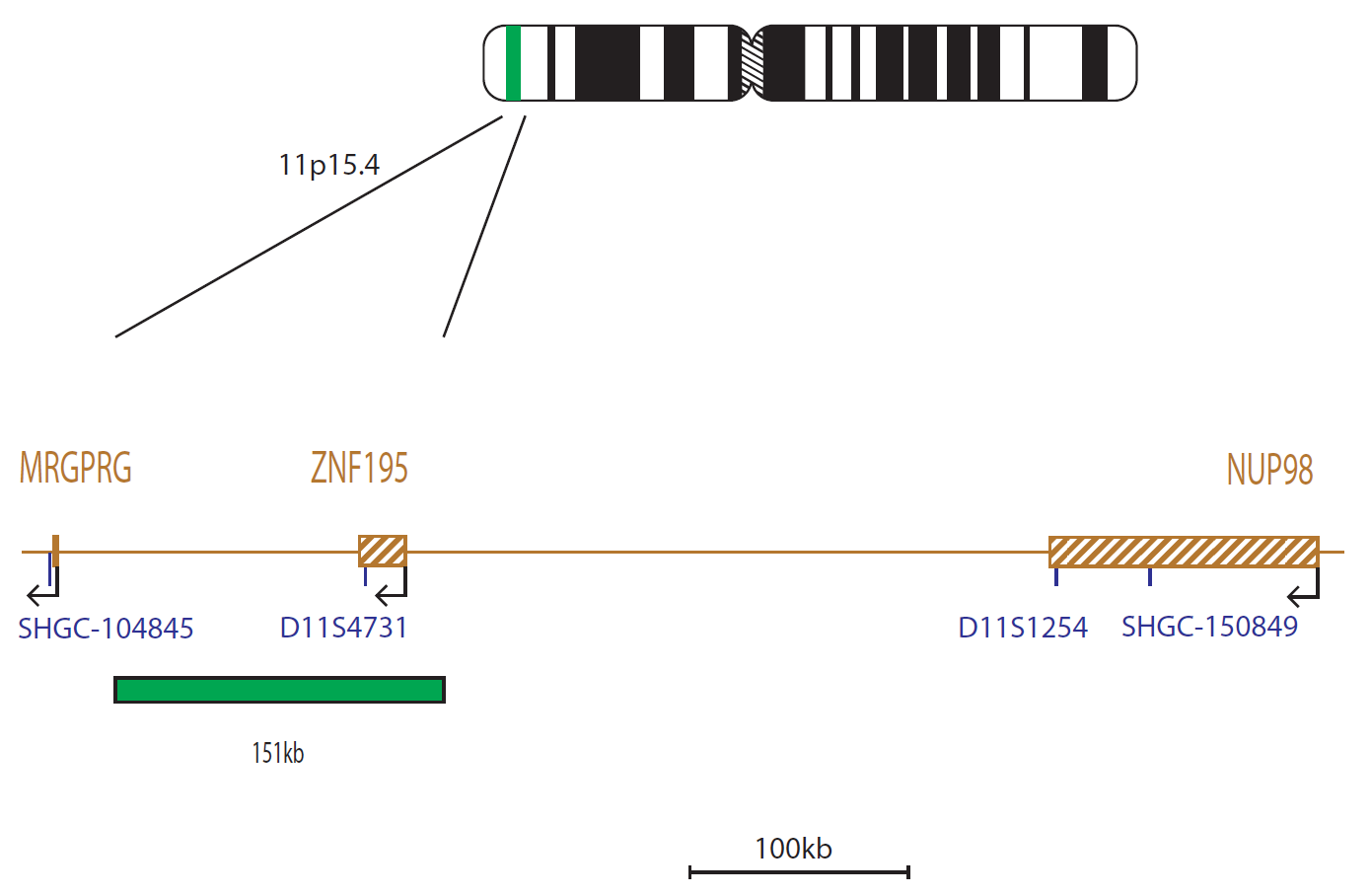 Fluorescence in situ hybridization (FISH) chromosome map showing a probe distal to the NUP98 gene.