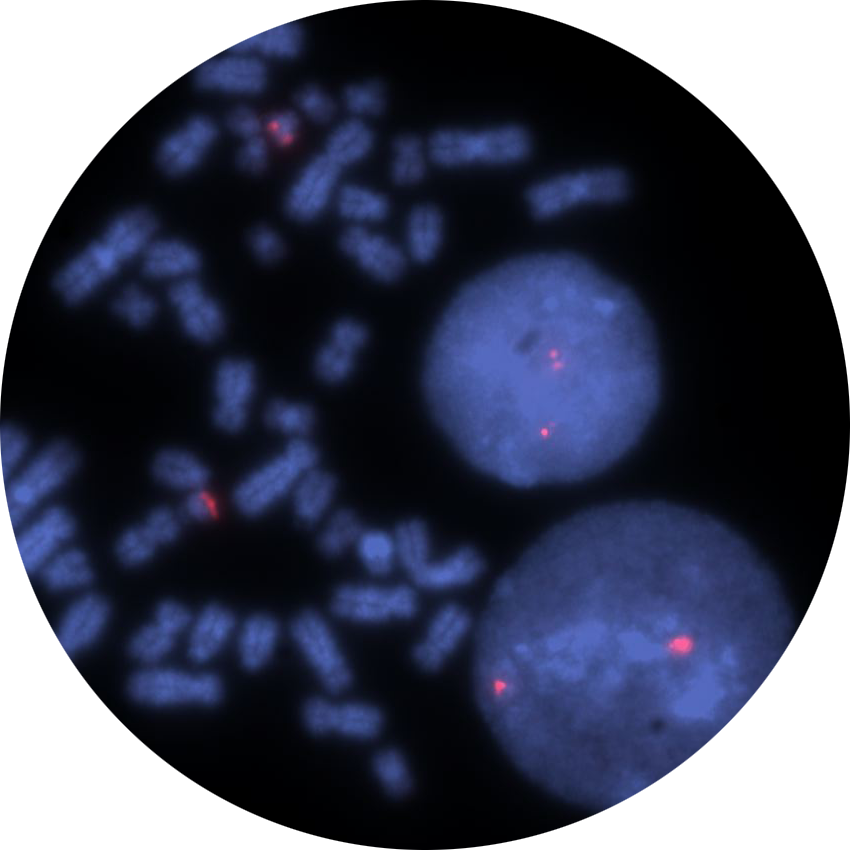 Fluorescence in situ hybridization (FISH) microscope image of the CytoCell AML1 (RUNX1) Proximal Probe Red.