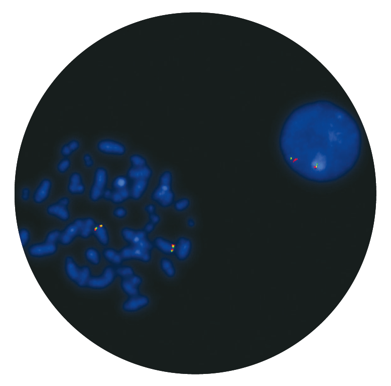 Fluorescence in situ hybridisation (FISH) microscope image of the CytoCell cMYC (MYC) Breakapart probe.