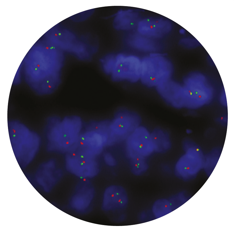 Fluorescence in situ hybridization (FISH) microscope image of the CytoCell BCL2 Breakapart probe.