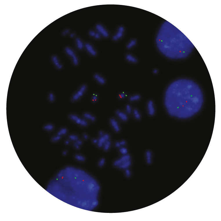 Fluorescence in situ hybridization (FISH) microscope image of the CytoCell CBFβ/MYH11 Translocation, Dual Fusion probe.