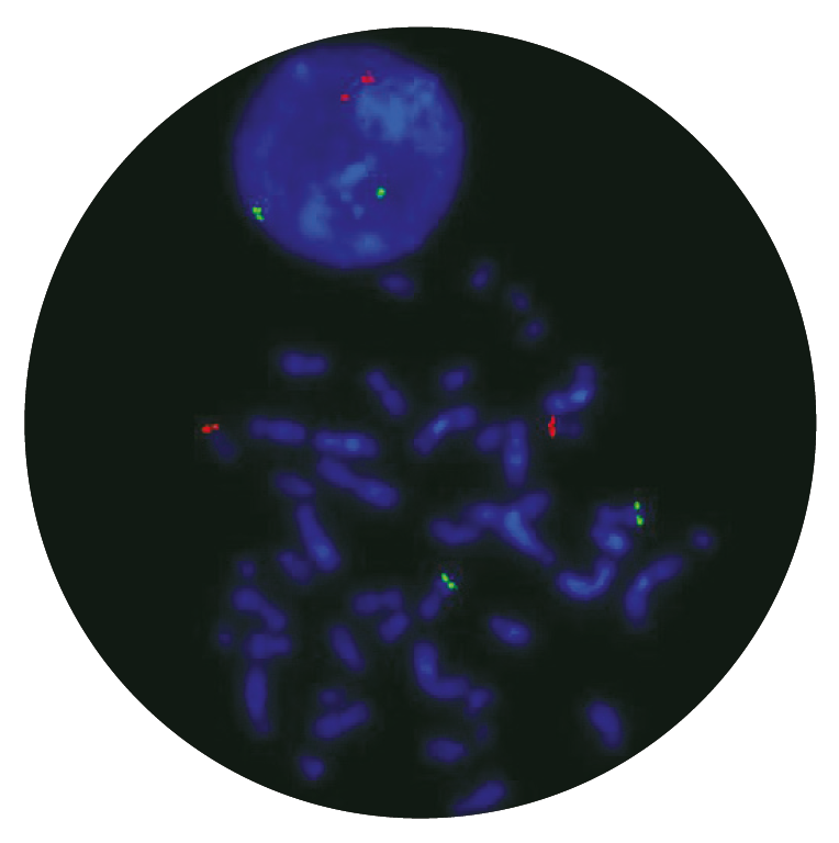 Fluorescence in situ hybridisation (FISH) microscope image of the CytoCell P53 (TP53)/ATM Probe Combination.