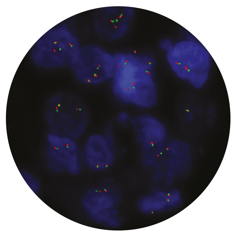 Fluorescence in situ hybridization (FISH) microscope image of the CytoCell BCL6 Breakapart probe.