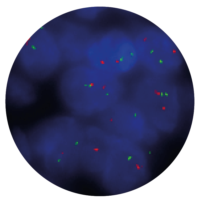 Fluorescence in situ hybridization (FISH) microscope image of the CytoCell FLI1/EWSR1 Translocation, Dual Fusion probe.