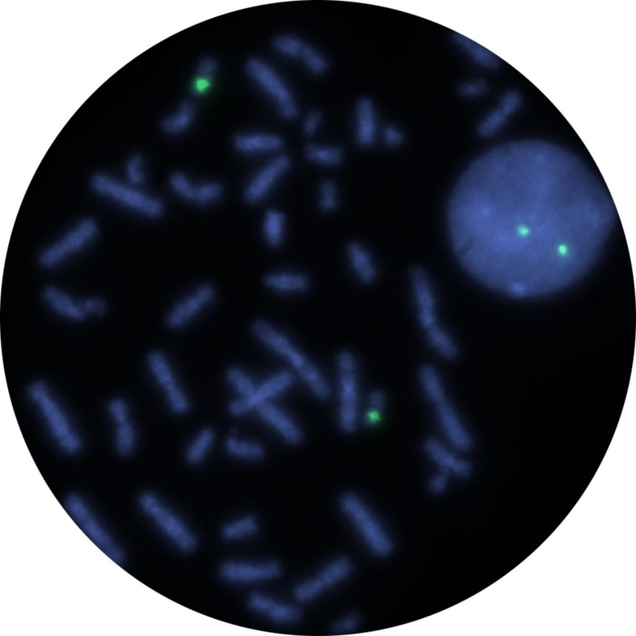 Fluorescence in situ hybridization (FISH) microscope image of the CytoCell Centromere 17 Probe Green.