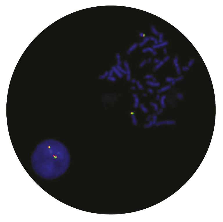 Fluorescence in situ hybridisation (FISH) microscope image of the CytoCell P2RY8 Deletion probe.
