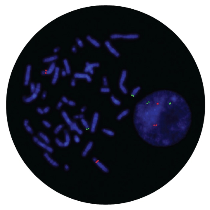 Fluorescence in situ hybridization (FISH) microscope image of the CytoCell IGH/CCND3 Translocation, Dual Fusion probe.