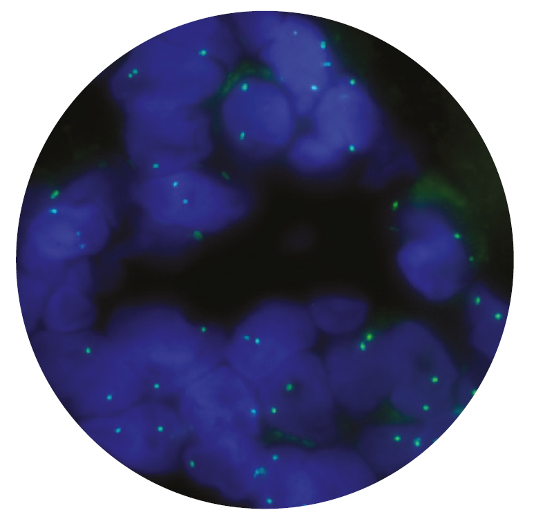 Fluorescence in situ hybridization (FISH) microscope image of the CytoCell FOXO1 Proximal Probe Green.