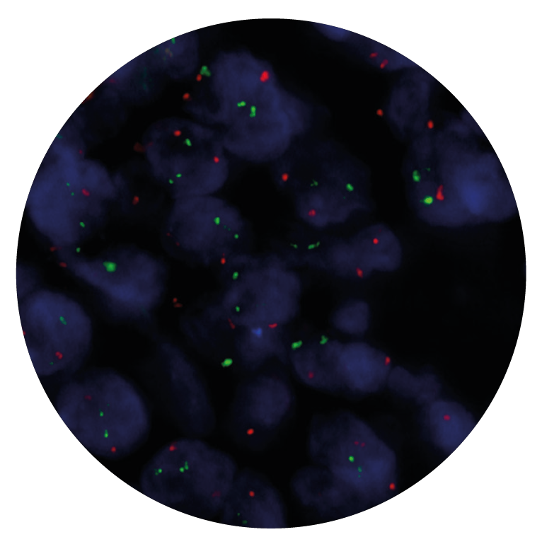 Fluorescence in situ hybridization (FISH) microscope image of the CytoCell IGH/MYC Translocation, Dual Fusion probe.