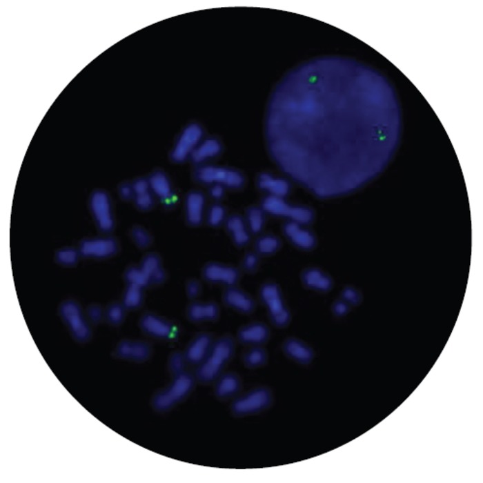 Fluorescence in situ hybridization (FISH) microscope image of the CytoCell DEK Probe Green.