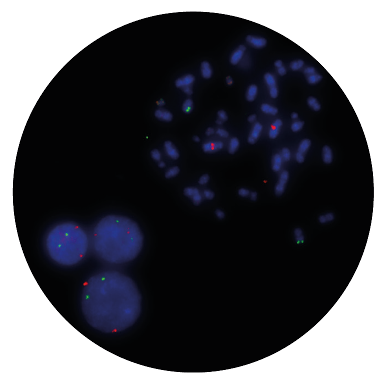 Fluorescence in situ hybridisation (FISH) microscope image of the CytoCell MLL (KMT2A)/AFF1 Translocation, Dual Fusion probe.