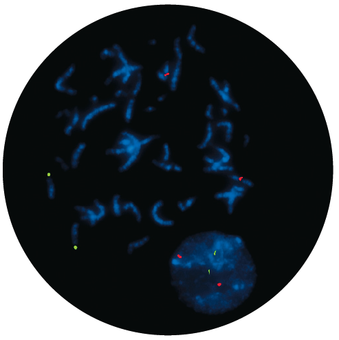 Fluorescence in situ hybridisation (FISH) microscope image of the CytoCell IGH/MYEOV Translocation, Dual Fusion probe.
