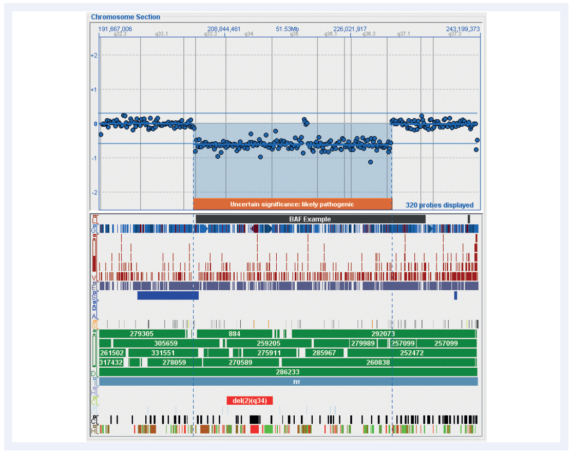 aCGH software data showing how fully customisable tracks in CytoSure Interpret Software simplify aberration interpretation.